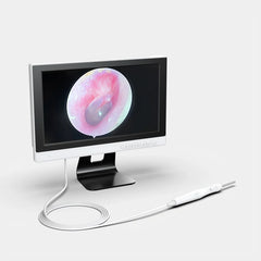 1280p Display Ear Cleaner Otoscope Endoscope Camera 3.9mm 10.1 Inch Hd Screen Digital Camera Otoscope for Ear Monitor Earpick