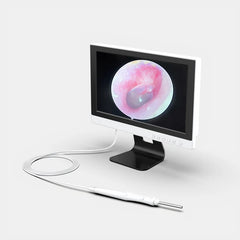 1280p Display Ear Cleaner Otoscope Endoscope Camera 3.9mm 10.1 Inch Hd Screen Digital Camera Otoscope for Ear Monitor Earpick