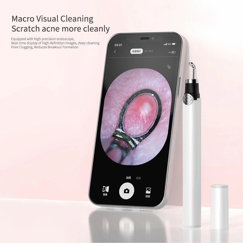 M3 Visual Pore Cleaner Boot Directly Connected To Mobile Phone Visual Blackhead Acne Needle Squeeze Acne Home Beauty Cleaning