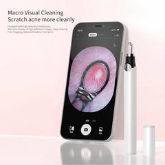 M3 Visual Pore Cleaner Boot Directly Connected To Mobile Phone Visual Blackhead Acne Needle Squeeze Acne Home Beauty Cleaning