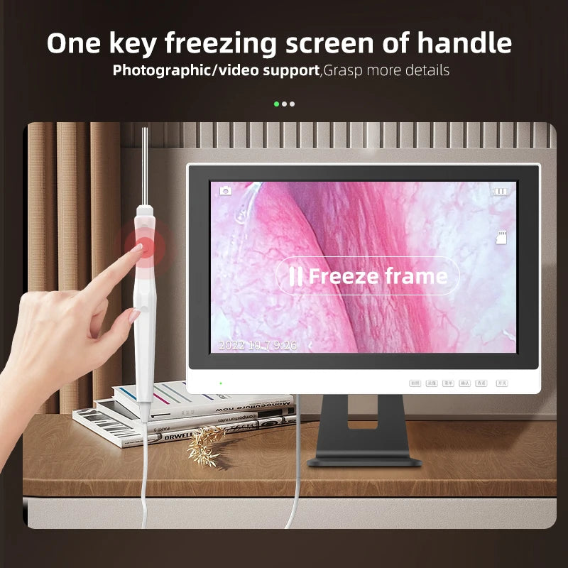 1280p Display Ear Cleaner Otoscope Endoscope Camera 3.9mm 10.1 Inch Hd Screen Digital Camera Otoscope for Ear Monitor Earpick
