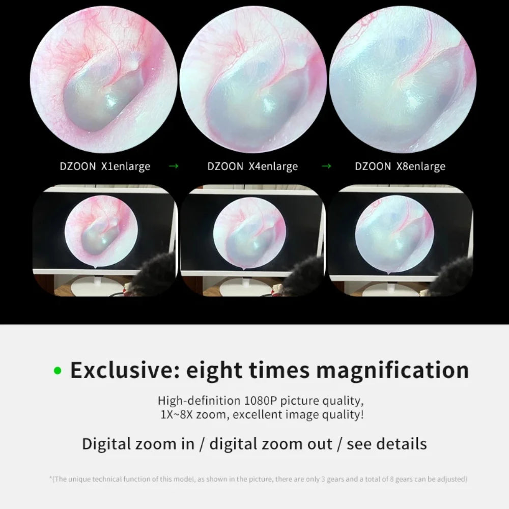 JIUTAN  Ear Endoscope Camera Endoscopy Rigid Portable 1080p Endoscopic 0 30 70 Degree Flexible Nasal Nose Medical ENT Endoscope