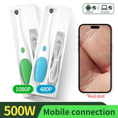 M3 Visual Pore Cleaner Boot Directly Connected to Mobile Phone Visual Blackhead Acne Needle Squeeze Acne Home Beauty Cleaning