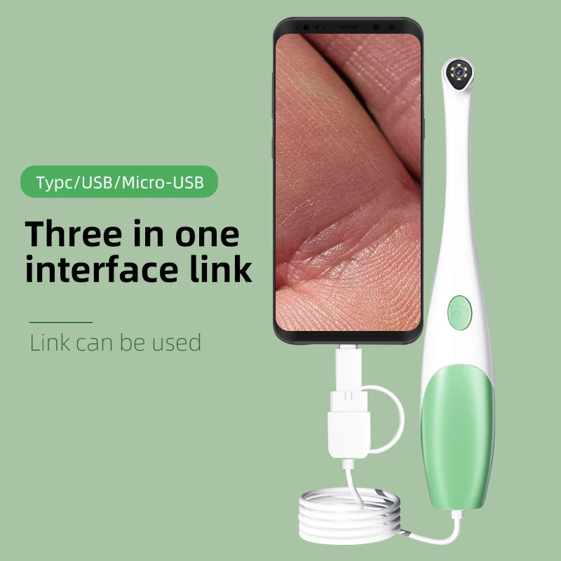 M3 Visual Pore Cleaner Boot Directly Connected to Mobile Phone Visual Blackhead Acne Needle Squeeze Acne Home Beauty Cleaning