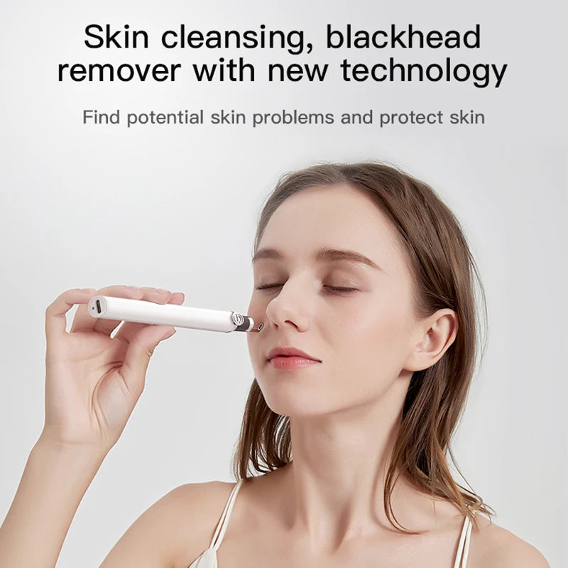 M3 Visual Pore Cleaner Boot Directly Connected To Mobile Phone Visual Blackhead Acne Needle Squeeze Acne Home Beauty Cleaning